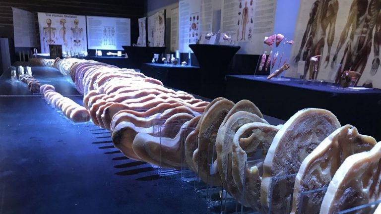 Omstreden ‘Real Human Bodies’ tentoonstelling gaat door ondanks beschuldigingen ?