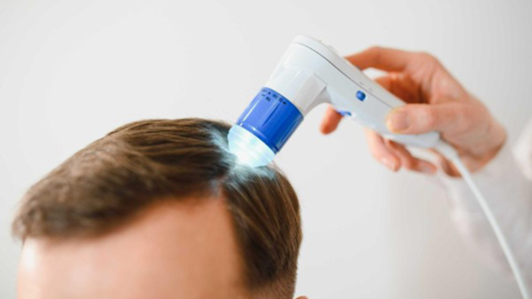 Onze Expertise Maakt Ons de Beste Haarkliniek van Nederland: Hairtec [Advertorial]